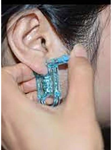 One Time Use Disposable Ear Piercing Tool