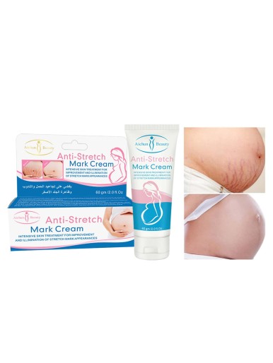 Stretch Mark Repair Cream