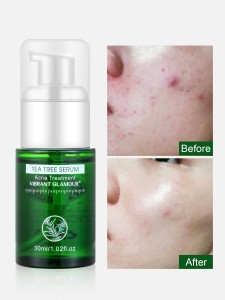 Tea Tree Acne Treatment Serum