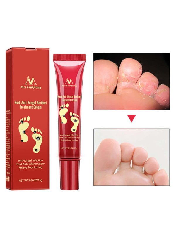 Herb Anti-Fungal Foot Treatment Cream